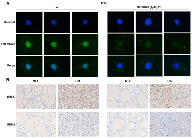 MDM2 Antibody in Immunohistochemistry (IHC)