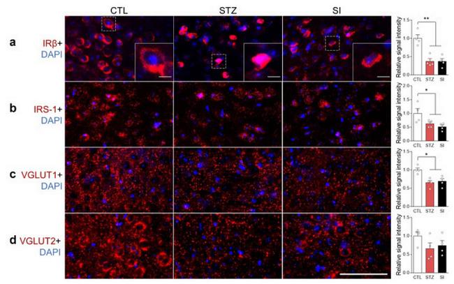 VGLUT2 Antibody in Immunohistochemistry (IHC)