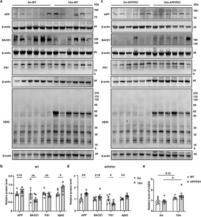 beta Amyloid Antibody in Western Blot (WB)