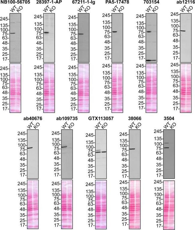 TBK1 Antibody in Western Blot (WB)