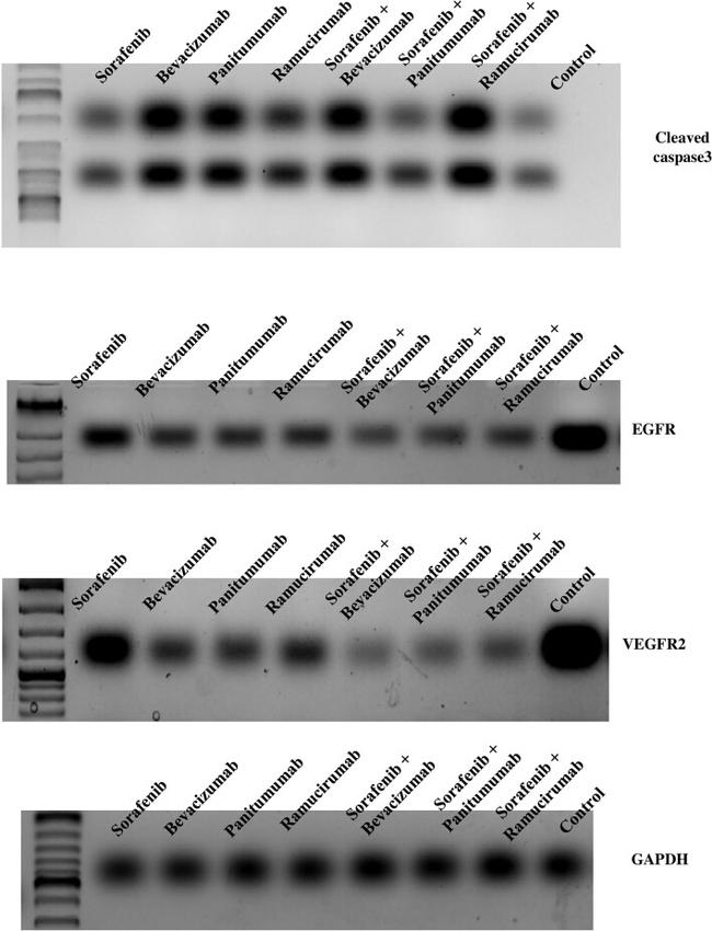 EGFR Antibody in Western Blot (WB)