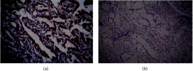 ErbB2 (HER-2) Antibody in Immunohistochemistry (IHC)