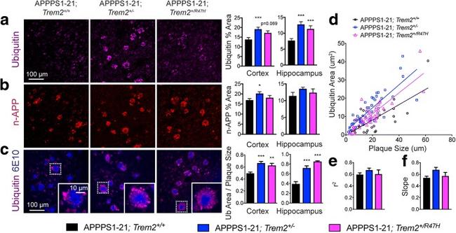 Ubiquitin Antibody in Immunohistochemistry (IHC)