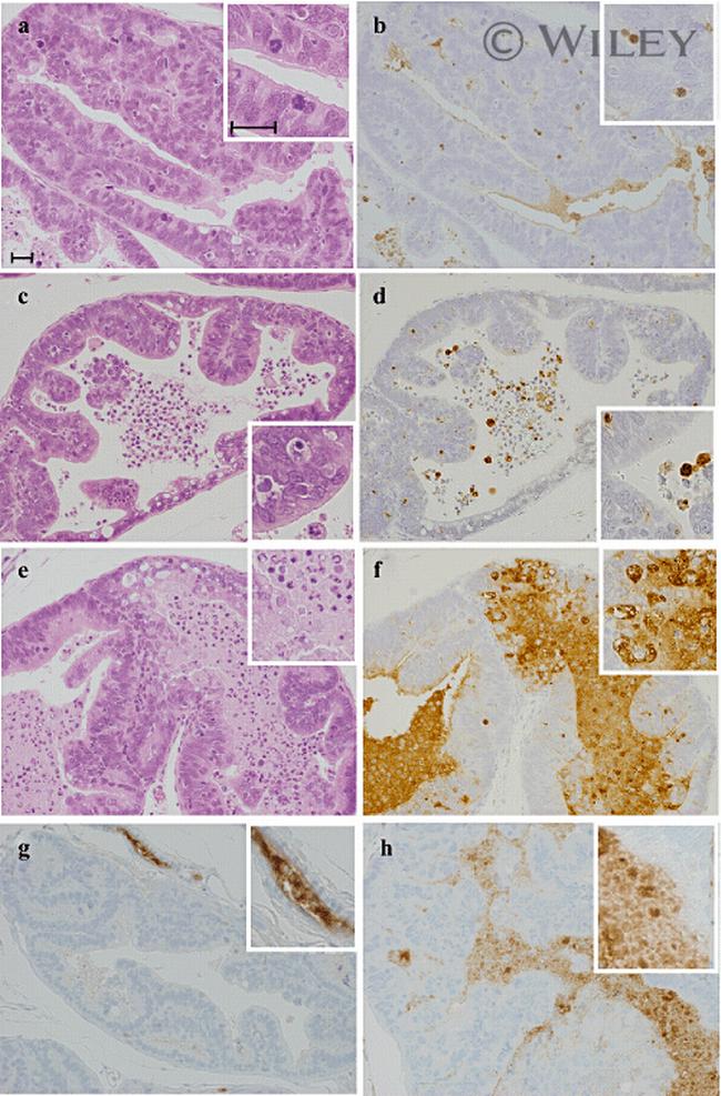 Androgen Receptor Antibody in Immunohistochemistry (IHC)