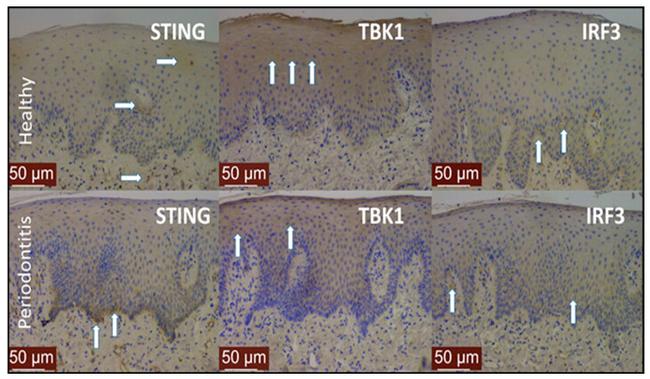 TBK1 Antibody in Immunohistochemistry (IHC)