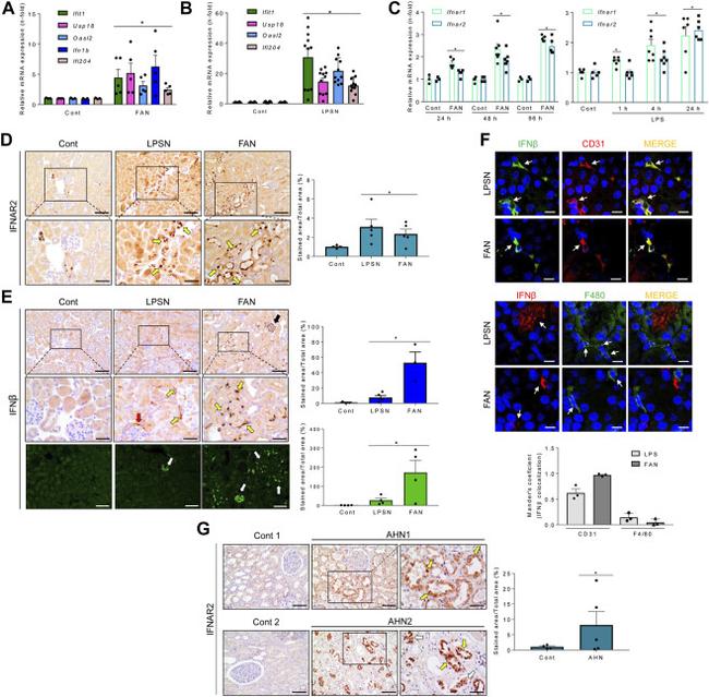 IFN beta Antibody in Immunohistochemistry (IHC)