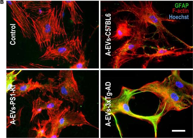 Mouse IgG (H+L) Cross-Adsorbed Secondary Antibody in Immunocytochemistry (ICC/IF)