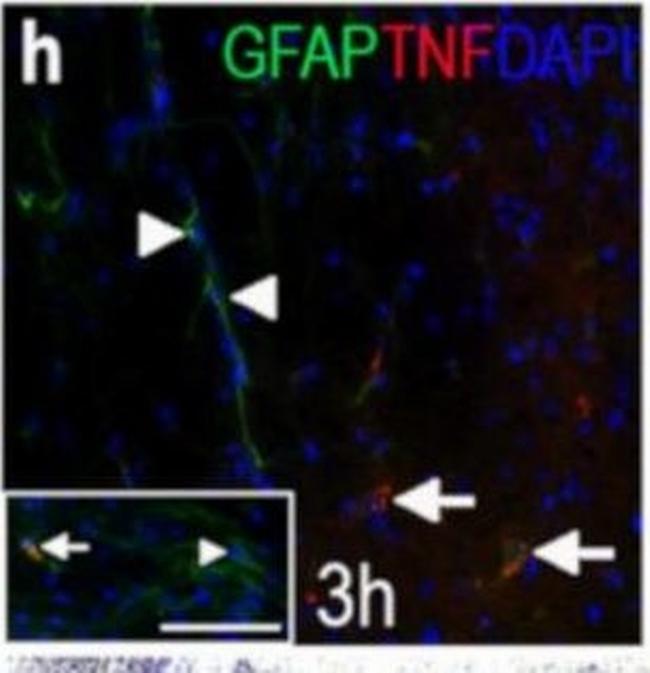 Rabbit IgG (H+L) Cross-Adsorbed Secondary Antibody in Immunohistochemistry (IHC)