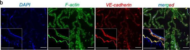 Rabbit IgG (H+L) Cross-Adsorbed Secondary Antibody in Immunocytochemistry (ICC/IF)