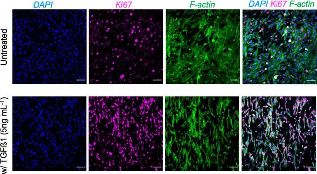 Mouse IgG (H+L) Cross-Adsorbed Secondary Antibody in Immunocytochemistry (ICC/IF)