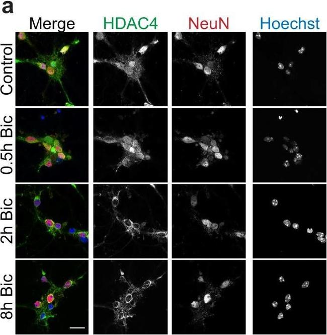 Rabbit IgG (H+L) Cross-Adsorbed Secondary Antibody in Immunocytochemistry (ICC/IF)