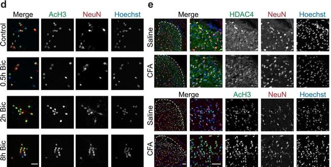 Rabbit IgG (H+L) Cross-Adsorbed Secondary Antibody in Immunocytochemistry (ICC/IF)