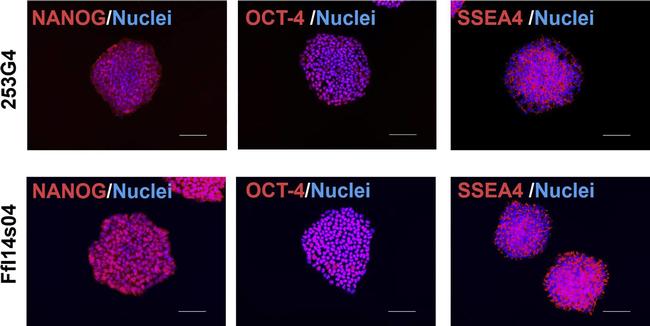 Rabbit IgG (H+L) Highly Cross-Adsorbed Secondary Antibody in Immunocytochemistry (ICC/IF)