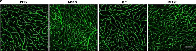 Rat IgG (H+L) Cross-Adsorbed Secondary Antibody in Immunohistochemistry (IHC)