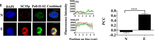 Mouse IgG (H+L) Highly Cross-Adsorbed Secondary Antibody in Immunocytochemistry (ICC/IF)