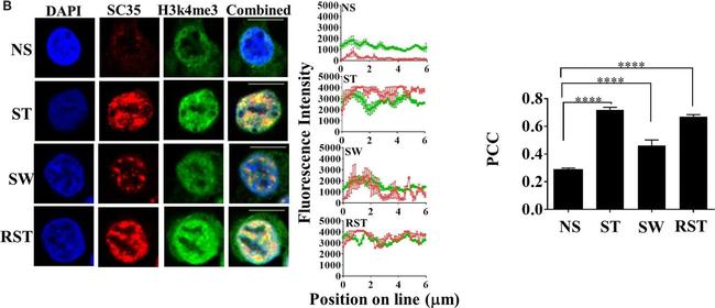 Mouse IgG (H+L) Highly Cross-Adsorbed Secondary Antibody in Immunocytochemistry (ICC/IF)