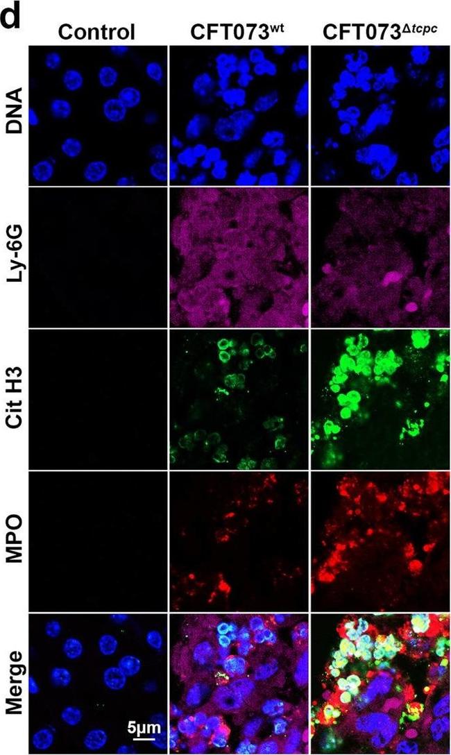 Rabbit IgG (H+L) Cross-Adsorbed Secondary Antibody in Immunocytochemistry (ICC/IF)