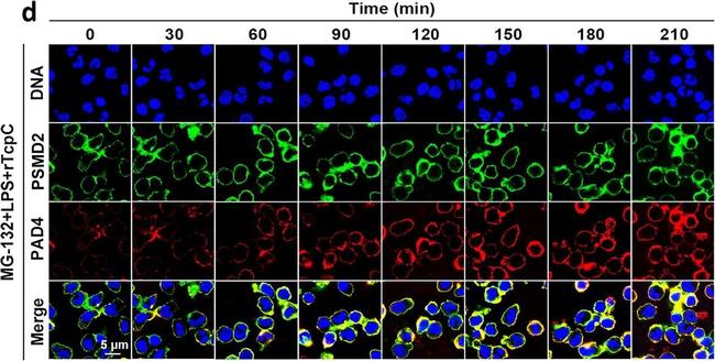 Rabbit IgG (H+L) Cross-Adsorbed Secondary Antibody in Immunocytochemistry (ICC/IF)