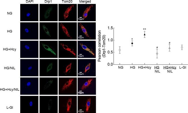 Rabbit IgG (H+L) Cross-Adsorbed Secondary Antibody in Immunocytochemistry (ICC/IF)