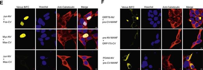 Rabbit IgG (H+L) Cross-Adsorbed Secondary Antibody in Immunocytochemistry (ICC/IF)