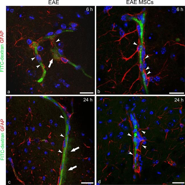 Rabbit IgG (H+L) Cross-Adsorbed Secondary Antibody in Immunohistochemistry (IHC)