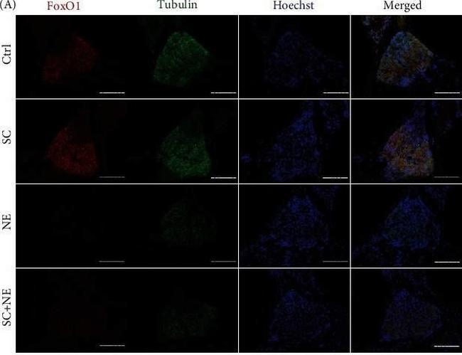 Rabbit IgG (H+L) Cross-Adsorbed Secondary Antibody in Immunohistochemistry (Paraffin) (IHC (P))