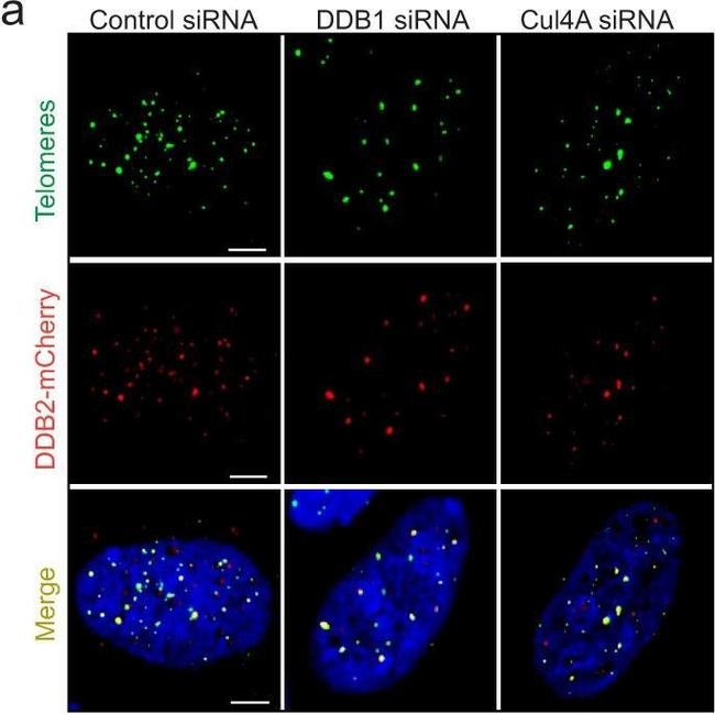 Rabbit IgG (H+L) Cross-Adsorbed Secondary Antibody in Immunocytochemistry (ICC/IF)