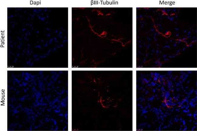 Rabbit IgG (H+L) Cross-Adsorbed Secondary Antibody in Immunohistochemistry (Frozen) (IHC (F))