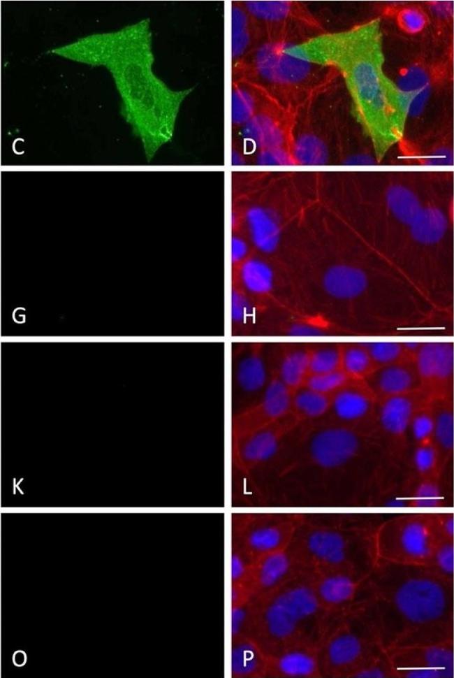 Mouse IgG (H+L) Highly Cross-Adsorbed Secondary Antibody in Immunocytochemistry (ICC/IF)