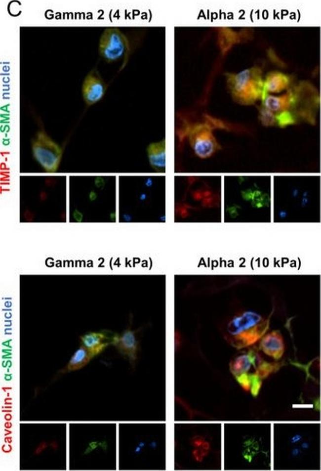 Mouse IgG (H+L) Highly Cross-Adsorbed Secondary Antibody in Immunohistochemistry (Paraffin) (IHC (P))