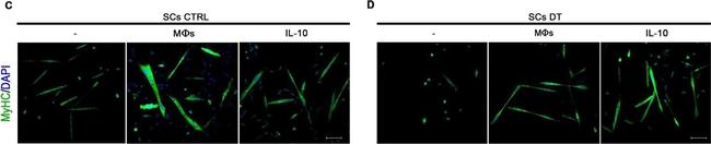 Mouse IgG (H+L) Highly Cross-Adsorbed Secondary Antibody in Immunocytochemistry (ICC/IF)