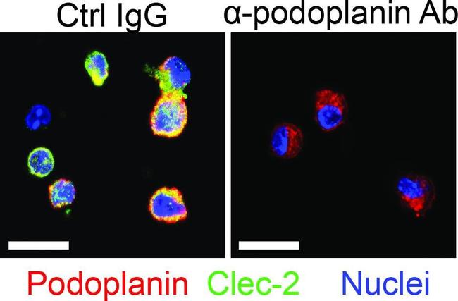 Rabbit IgG (H+L) Highly Cross-Adsorbed Secondary Antibody in Immunocytochemistry (ICC/IF)