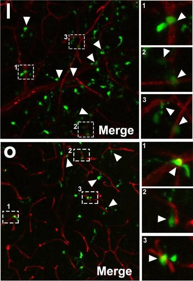 Goat IgG (H+L) Highly Cross-Adsorbed Secondary Antibody in Immunohistochemistry (Paraffin) (IHC (P))