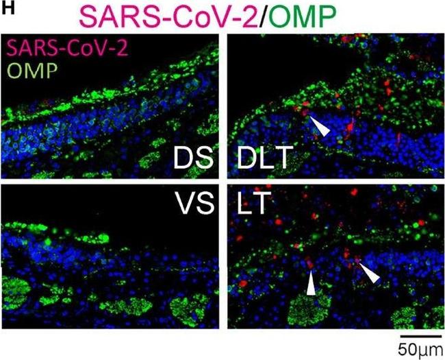 Rabbit IgG (H+L) Highly Cross-Adsorbed Secondary Antibody in Immunohistochemistry (IHC)