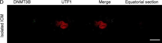 Rabbit IgG (H+L) Highly Cross-Adsorbed Secondary Antibody in Immunohistochemistry (PFA fixed) (IHC (PFA))