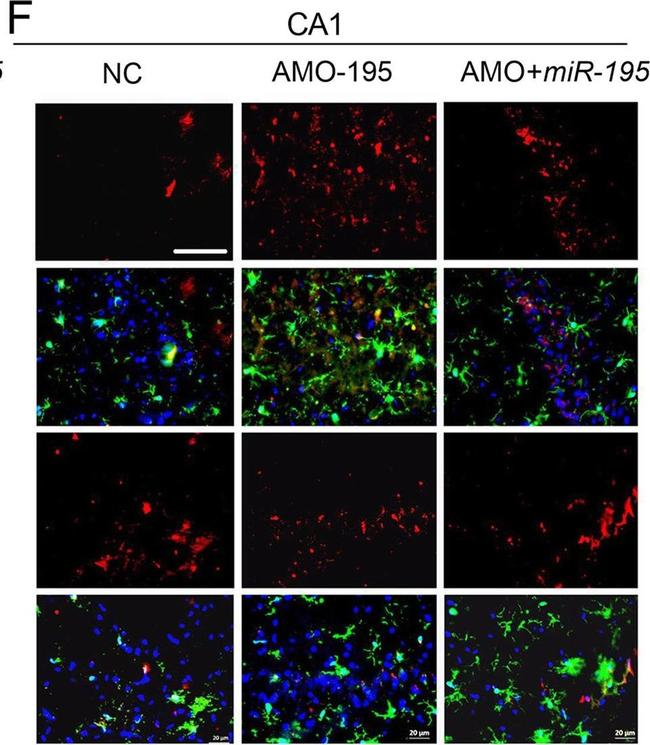 Rabbit IgG (H+L) Highly Cross-Adsorbed Secondary Antibody in Immunocytochemistry (ICC/IF)