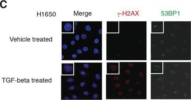 Mouse IgG (H+L) Highly Cross-Adsorbed Secondary Antibody in Immunocytochemistry (ICC/IF)