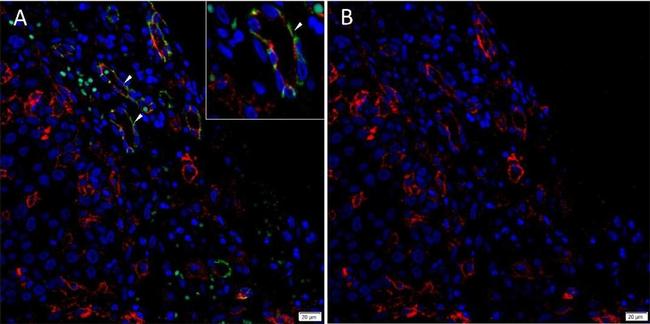 Rabbit IgG (H+L) Highly Cross-Adsorbed Secondary Antibody in Immunohistochemistry (IHC)