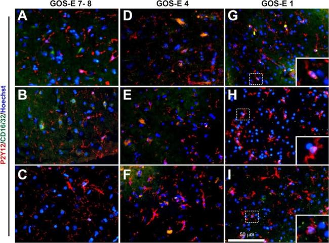 Rabbit IgG (H+L) Highly Cross-Adsorbed Secondary Antibody in Immunohistochemistry (Frozen) (IHC (F))