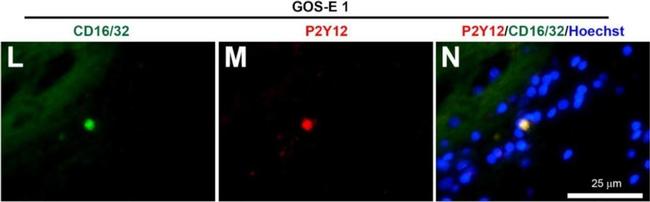 Rabbit IgG (H+L) Highly Cross-Adsorbed Secondary Antibody in Immunohistochemistry (Frozen) (IHC (F))