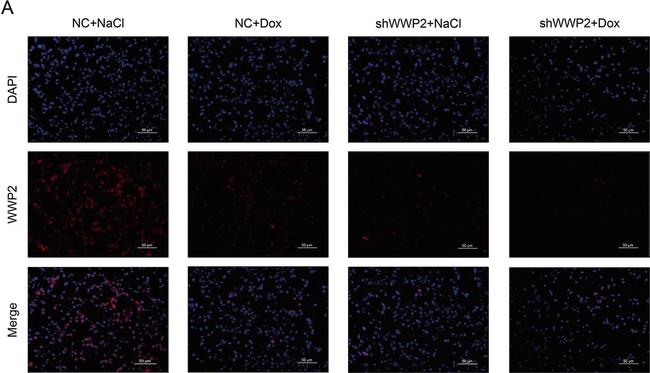 Rabbit IgG (H+L) Highly Cross-Adsorbed Secondary Antibody in Immunohistochemistry (IHC)