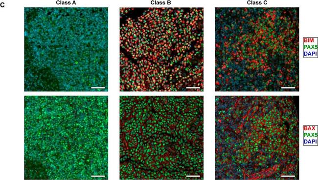 Rabbit IgG (H+L) Highly Cross-Adsorbed Secondary Antibody in Immunohistochemistry (IHC)