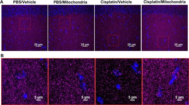 Mouse IgG (H+L) Secondary Antibody in Immunohistochemistry (IHC)