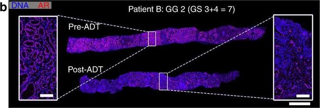 Rabbit IgG (H+L) Highly Cross-Adsorbed Secondary Antibody in Immunohistochemistry (Paraffin) (IHC (P))