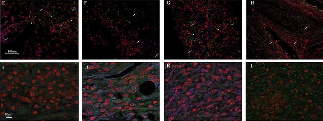 Rabbit IgG (H+L) Highly Cross-Adsorbed Secondary Antibody in Immunohistochemistry (Paraffin) (IHC (P))