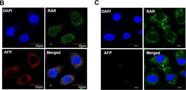 Mouse IgG (H+L) Cross-Adsorbed Secondary Antibody in Immunocytochemistry (ICC/IF)