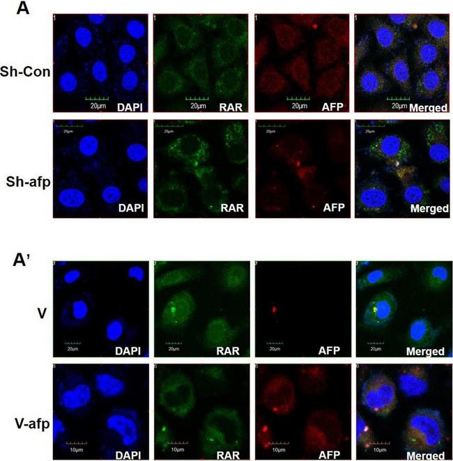 Mouse IgG (H+L) Cross-Adsorbed Secondary Antibody in Immunocytochemistry (ICC/IF)