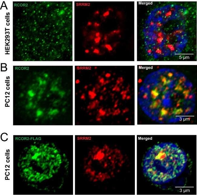 Rabbit IgG (H+L) Secondary Antibody in Immunocytochemistry (ICC/IF)