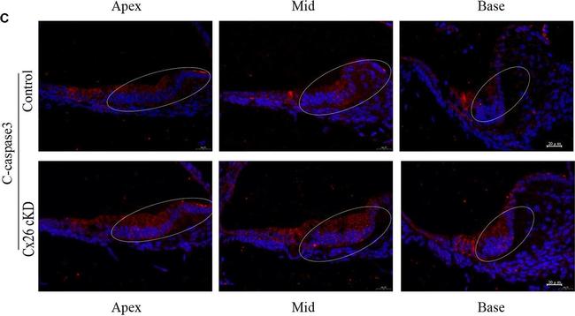 Rabbit IgG (H+L) Secondary Antibody in Immunohistochemistry (Paraffin) (IHC (P))