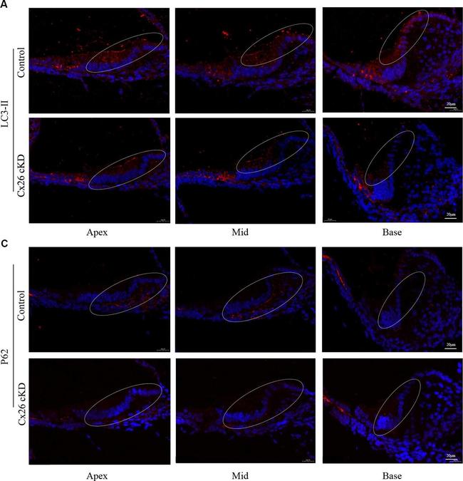 Rabbit IgG (H+L) Secondary Antibody in Immunohistochemistry (Paraffin) (IHC (P))